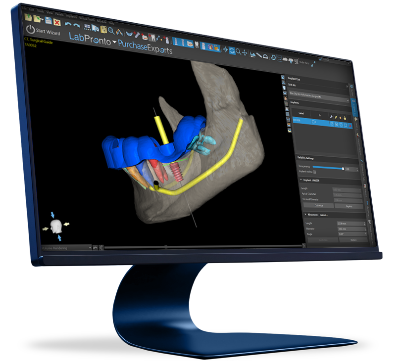 Official BlueSkyPlan monitor visual showing implant planning and surgical guide design