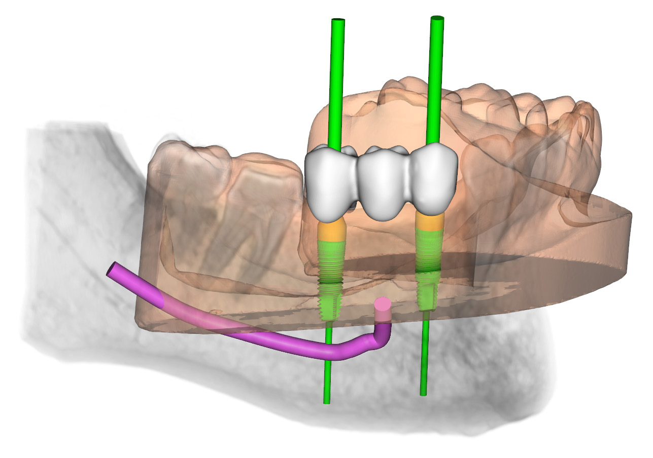 3Diagnosys planning illustration
