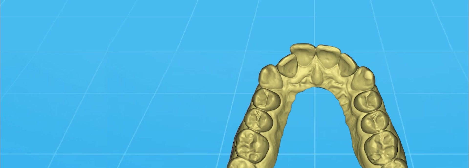 dentOne OneDESIGN illustration