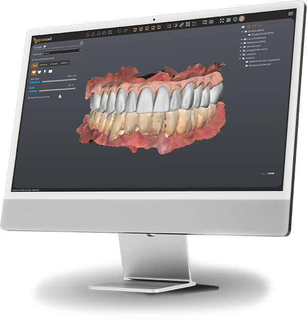 HypsoCAD restoration-design interface