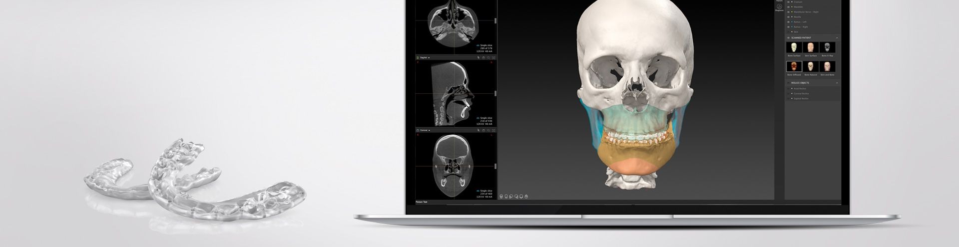 IPS CaseDesigner product illustration