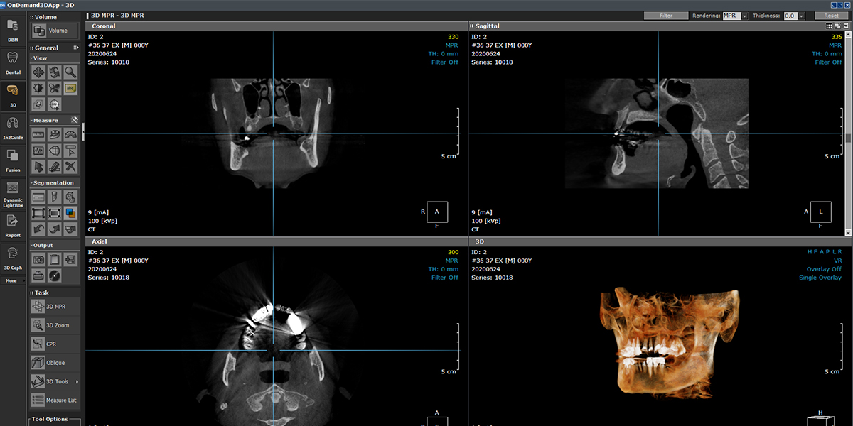 OnDemand3D volume rendering screen