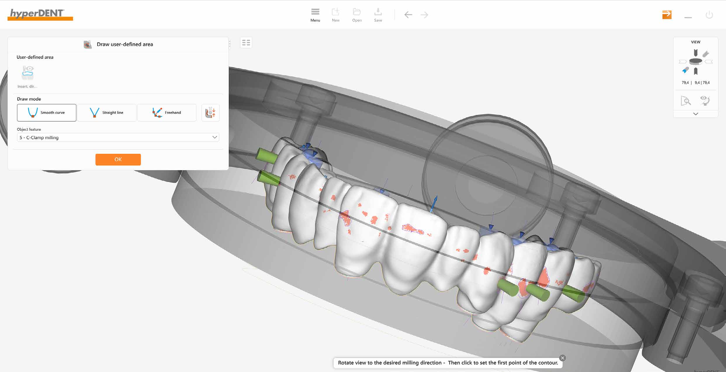Official hyperDENT V10 interface showing a bridge and milling area tools